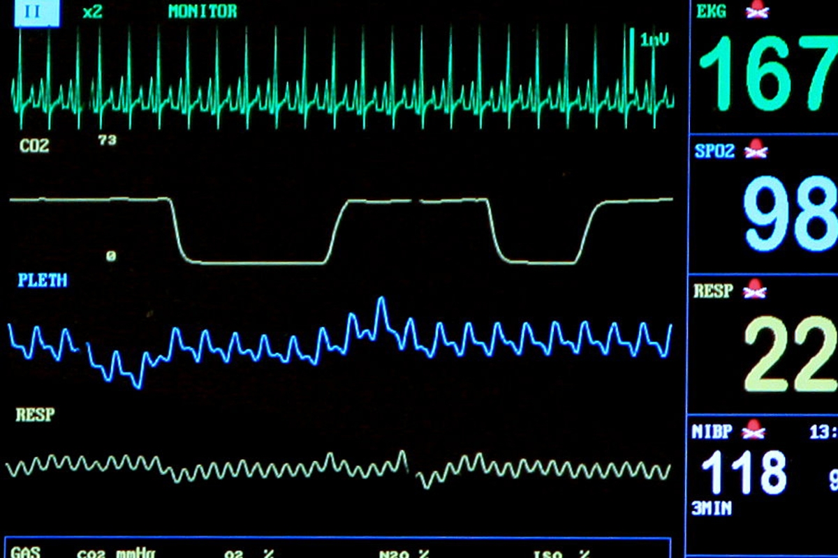 Le Health Data Hub, plateforme de données médicales destinées à l'IA, éveille l'appétit des GAFAM.